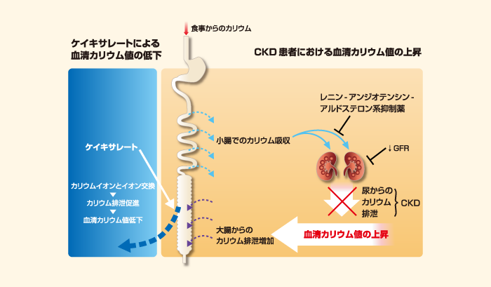 メカニズム